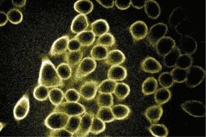 Immunofluorescent staining of Hela cells (Human cervical epitheloid carcinoma, ATCC CCL-2. (SPTBN1 Antikörper  (AA 2101-2189))