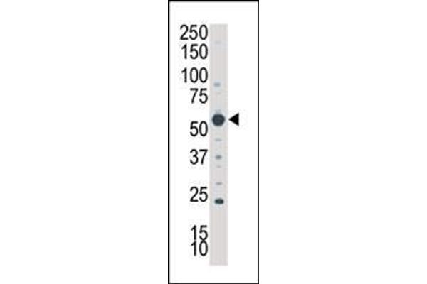 SGK3 Antikörper  (N-Term)