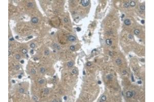 Immunohistochemistry (IHC) image for anti-Transforming Growth Factor, alpha (TGFA) (AA 24-98) antibody (ABIN7425710)