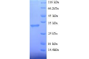 SDS-PAGE (SDS) image for Histone Deacetylase 7 (HDAC7) (AA 645-915), (partial) protein (His tag) (ABIN5713108)