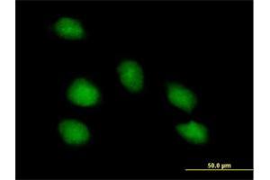 Immunofluorescence of purified MaxPab antibody to PNMA1 on HeLa cell.