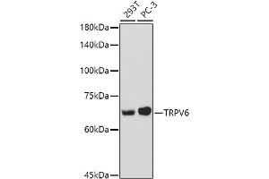 TRPV6 Antikörper  (AA 1-100)