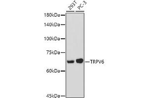 Western blot analysis of extracts of various cell lines, using TRPV6 antibody (ABIN7270921) at 1:1000 dilution. (TRPV6 Antikörper  (AA 1-100))