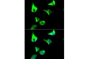 Immunofluorescence analysis of HeLa cell using RRM1 antibody. (RRM1 Antikörper  (AA 593-792))
