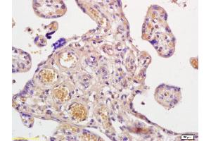 Formalin-fixed and paraffin embedded human placenta labeled with Anti-Prostaglandin E Receptor EP2 Polyclonal Antibody, Unconjugated (ABIN755248) at 1:200 followed by conjugation to the secondary antibody and DAB staining. (PTGER2 Antikörper  (AA 271-358))