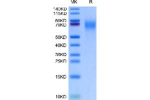 SDS-PAGE (SDS) image for CD200 Receptor 1 (CD200R1) (AA 25-267) protein (His tag) (ABIN7274101)