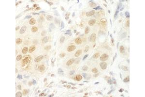 anti-UTP6, Small Subunit (SSU) Processome Component, Homolog (UTP6) (AA 565-597) antibody