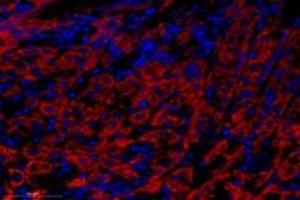 Immunofluorescent analysis of paraformaldehyde-fixed mouse stomach using Epsin-3 (ABIN7073856) at dilution of 1: 1400 (EPN3 Antikörper)