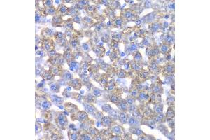 Immunohistochemistry of paraffin-embedded mouse liver using CCBL1 antibody. (CCBL1 Antikörper)