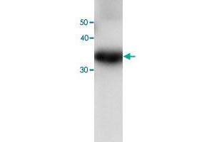Western blot analysis of recombinant PRDX6 protein with PRDX6 monoclonal antibody, clone 36  at 1:1000 dilution.