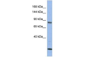 WB Suggested Anti-MAP3K11 Antibody Titration: 0. (MAP3K11 Antikörper  (Middle Region))