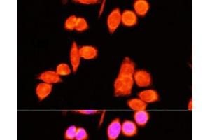 Immunofluorescence analysis of Hela cells using DNAJC19 Polyclonal Antibody at dilution of 1:100 (40x lens). (DNAJC19 Antikörper)