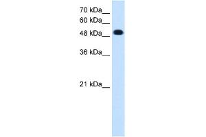 WB Suggested Anti-PTPRR Antibody Titration:  0. (PTPRR Antikörper  (C-Term))