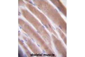 VEGF3 Antibody (N-term) immunohistochemistry analysis in formalin fixed and paraffin embedded human skeletal muscle followed by peroxidase conjugation of the secondary antibody and DAB staining.