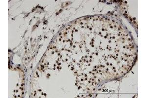 Image no. 2 for anti-F-Box Protein 9 (FBXO9) (AA 338-448) antibody (ABIN599547) (FBXO9 Antikörper  (AA 338-448))