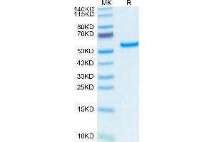 Human Pentraxin 2/SAP on Tris-Bis PAGE under reduced condition. (APCS Protein (AA 20-223) (Fc Tag))