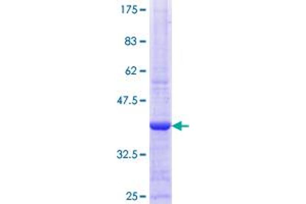 MSK1 Protein (AA 372-470) (GST tag)