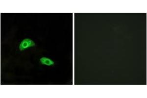 Immunofluorescence analysis of HeLa cells, using GPR174 Antibody. (GPR174 Antikörper  (AA 126-175))