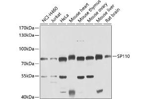 Western blot analysis of extracts of various cell lines, using SP110 antibody (ABIN6128744, ABIN6148311, ABIN6148313 and ABIN6223389) at 1:1000 dilution. (SP110 Antikörper  (AA 1-290))