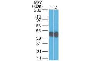 Western Blot Analysis (1) HeLa and (2) A431 lysate using Cytokeratin 18 Mouse Monoclonal Antibody (DC10). (Cytokeratin 18 Antikörper)