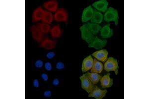 ABIN6259338 and ABIN6275436 staining Hela cells(45 min of heat-shock) by IF/ICC. (RAB3GAP2 Antikörper  (Internal Region))
