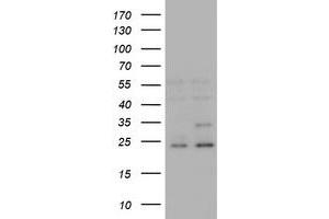 Image no. 4 for anti-RAB21, Member RAS Oncogene Family (RAB21) antibody (ABIN1500547) (RAB21 Antikörper)