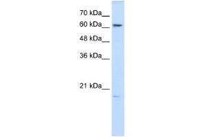 WB Suggested Anti-GPX3 Antibody Titration:  0.