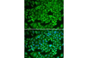 Immunofluorescence analysis of U2OS cells using NR0B1 antibody (ABIN5970870).