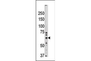 Western Blotting (WB) image for anti-Synovial Apoptosis Inhibitor 1, Synoviolin (SYVN1) (AA 58-88), (N-Term) antibody (ABIN1882139)