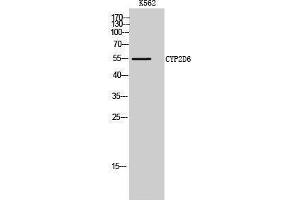Western Blotting (WB) image for anti-Cytochrome P450, Family 2, Subfamily D, Polypeptide 6 (CYP2D6) (C-Term) antibody (ABIN3184183)