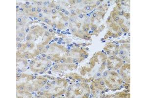 Immunohistochemistry of paraffin-embedded Rat kidney using PER1 Polyclonal Antibody at dilution of 1:100 (40x lens). (PER1 Antikörper)