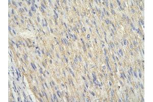 Immunohistochemistry (IHC) image for anti-E3 Ubiquitin-Protein Ligase SIAH1 (SIAH1) (N-Term) antibody (ABIN2778297)