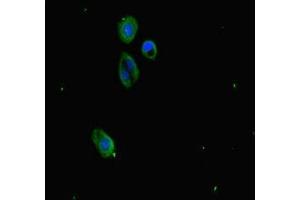 Immunofluorescence staining of HepG2 cells with ABIN7163811 at 1:333, counter-stained with DAPI. (SUZ12 Antikörper  (AA 131-305))