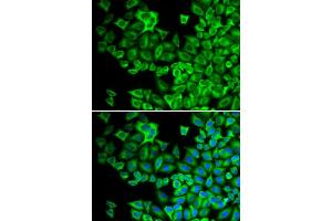 Immunofluorescence analysis of A549 cell using HCK antibody. (HCK Antikörper)