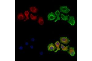 Citrate synthetase Antibody staining Hela cells by IF/ICC. (Citrate Synthetase (C-Term) Antikörper)
