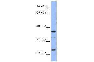 WB Suggested Anti-SOX21 Antibody Titration: 0. (SOX21 Antikörper  (Middle Region))