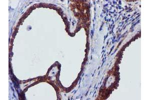 Immunohistochemical staining of paraffin-embedded Human breast tissue using anti-EPN2 mouse monoclonal antibody. (Epsin 2 Antikörper)