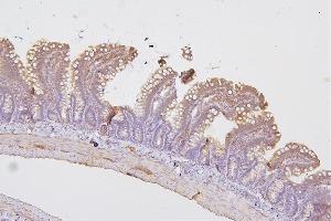 IHC analysis of PRKCD using anti-PRKCD antibody (ABIN7601631). (PKC delta Antikörper  (AA 4-676))