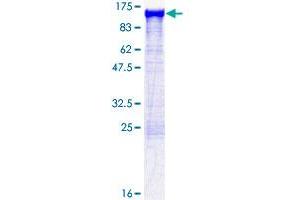 ACTN1 Protein (AA 1-892) (GST tag)