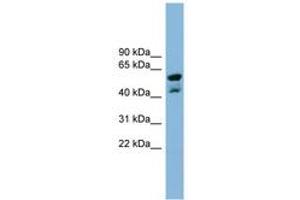 Image no. 1 for anti-Protein Phosphatase Methylesterase 1 (PPME1) (N-Term) antibody (ABIN6742049) (PPME1 Antikörper  (N-Term))