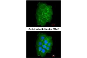 AP31081PU-N CAV2 antibody staining of Paraformaldehyde-Fixed A431 by Immunofluorescence at 1/200 dilution. (Caveolin 2 Antikörper  (AA 1-45))
