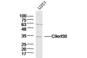 Lane 1: U251 lysates probed with C9orf30 Polyclonal Antibody, Unconjugated  at 1:300 overnight at 4˚C.
