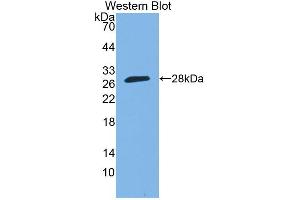 Western blot analysis of the recombinant protein. (SP140 Antikörper  (AA 443-655))