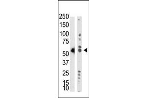 Western Blotting (WB) image for anti-tRNA Aspartic Acid Methyltransferase 1 (TRDMT1) (AA 300-400) antibody (ABIN356546) (Dnmt2 Antikörper  (AA 300-400))