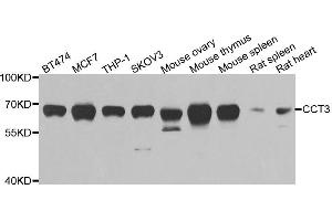 Western blot analysis of extracts of various cell lines, using CCT3 antibody. (CCT3 Antikörper)
