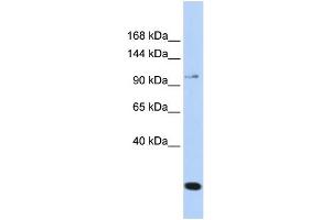WB Suggested Anti-TRPC6 Antibody Titration: 0. (TRPC6 Antikörper  (N-Term))