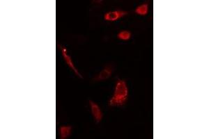 ABIN6275561 staining HepG2 cells by IF/ICC.