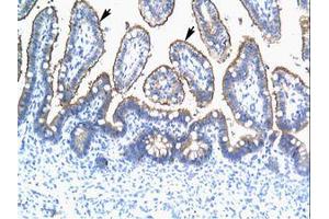 Image no. 2 for anti-Tripartite Motif Containing 15 (TRIM15) (AA 141-190) antibody (ABIN202591) (TRIM15 Antikörper  (AA 141-190))
