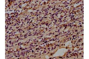 Immunohistochemistry (IHC) image for anti-CD14 (CD14) (AA 20-345) antibody (ABIN7160185)