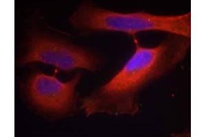 Immunofluorescence staining of methanol-fixed HeLa cells using Keratin 8 (Phospho-Ser74) Antibody (E011307, Red) (KRT8 Antikörper  (pSer74))